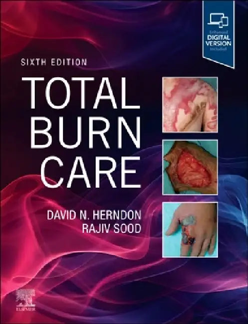 Total Burn Care by David Herndon, Rajiv Sood