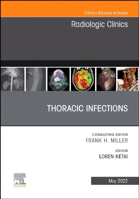 Thoracic Infections, an Issue of Radiologic Clinics of North America: Volume 60-3 by Loren Ketai