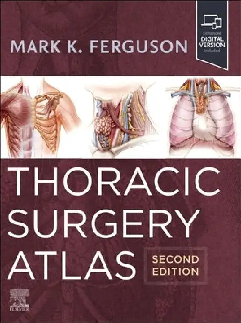 Thoracic Surgery Atlas by Mark K. Ferguson