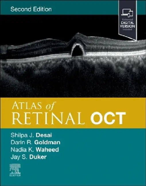 Atlas of Retinal Oct: Optical Coherence Tomography by Jay S. Duker
