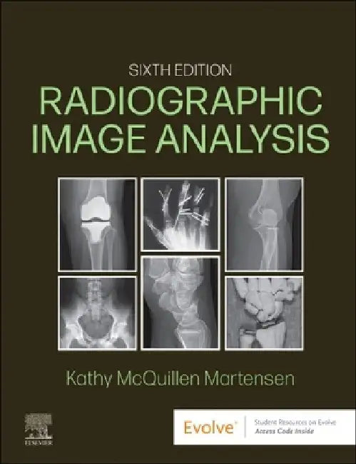 Radiographic Image Analysis by Kathy McQuillen-Martensen
