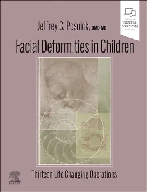 Facial Deformities in Children: Thirteen Life Changing Operations by Jeffrey C. Posnick