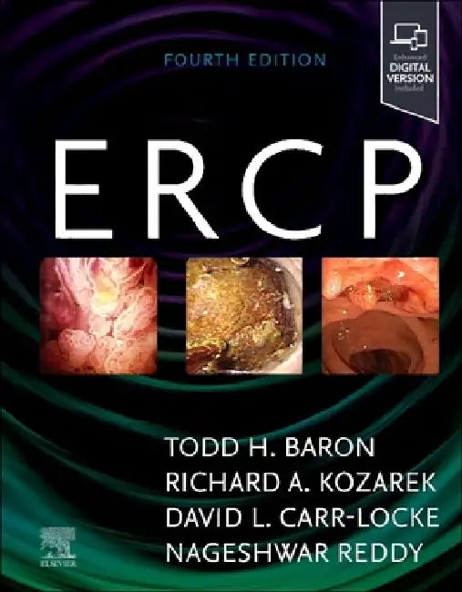 Ercp by Todd H. Baron