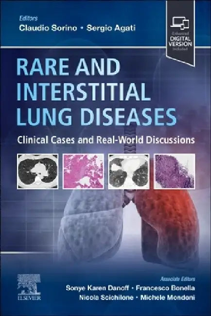 Rare and Interstitial Lung Diseases: Clinical Cases and Real-World Discussions by Claudio Sorino