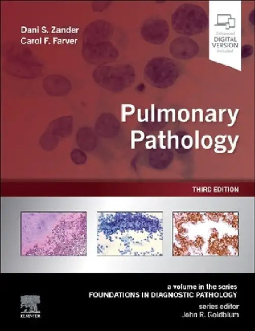 Pulmonary Pathology by Dani S. Zander