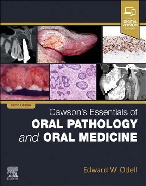Cawson's Essentials of Oral Pathology and Oral Medicine by Edward W. Odell