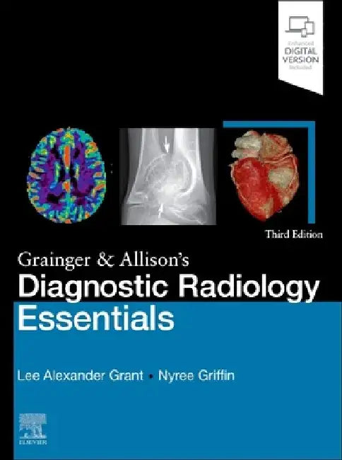 Grainger & Allison's Diagnostic Radiology Essentials by Lee A. Grant