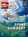Operative Techniques: Spine Surgery by Alexander R. Vaccaro, Eli M. Baron