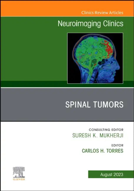 Spinal Tumors, an Issue of Neuroimaging Clinics of North America: Volume 33-3 by Carlos H. Torres