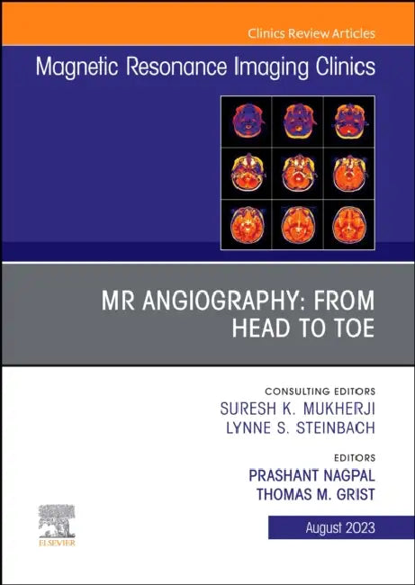 MR Angiography: From Head to Toe, an Issue of Magnetic Resonance Imaging Clinics of North America: Volume 31-3 by Prashant Nagpal, Thomas M. Grist