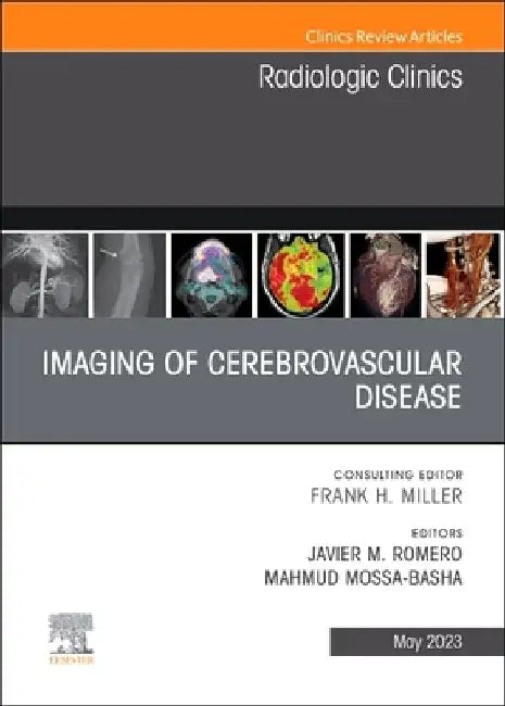 Imaging of Cerebrovascular Disease, an Issue of Radiologic Clinics of North America: Volume 61-3 by Javier M. Romero