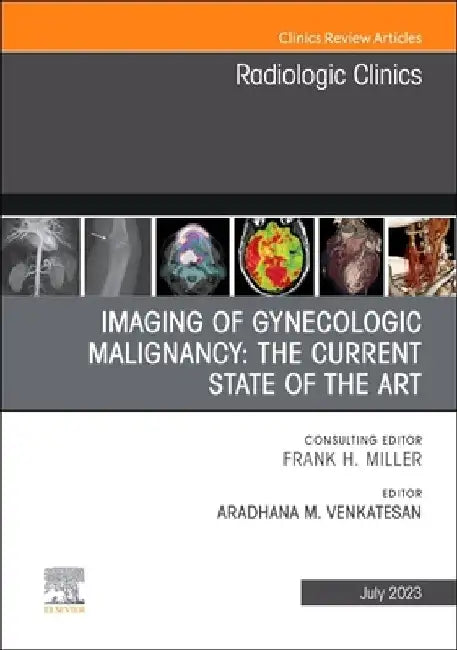 Imaging of Gynecologic Malignancy: The Current State of the Art, an Issue of Radiologic Clinics of North America: Volume 61-4 by Aradhana M. Venkatesan