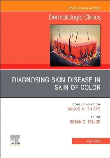 Diagnosing Skin Disease in Skin of Color, an Issue of Dermatologic Clinics: Volume 41-3 by Susan C. Taylor