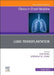 Lung Transplantation, an Issue of Clinics in Chest Medicine: Volume 44-1 by Luis Angel