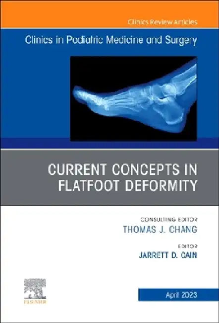 Current Concepts in Flatfoot Deformity, an Issue of Clinics in Podiatric Medicine and Surgery: Volume 40-2 by Jarrett D. Cain