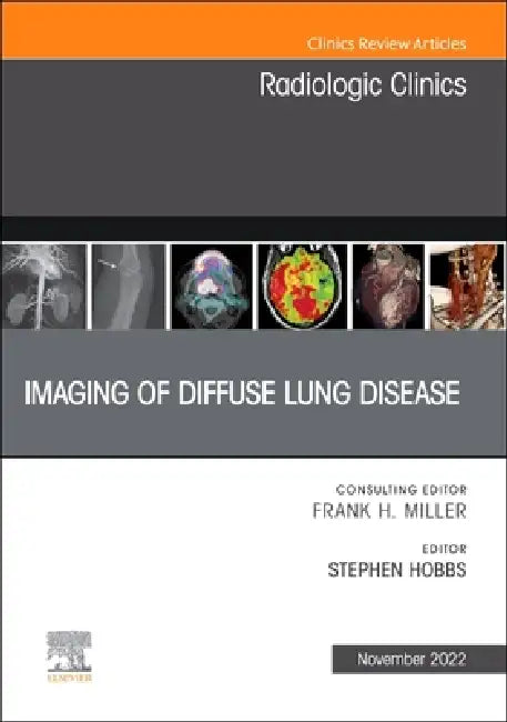 Imaging of Diffuse Lung Disease, an Issue of Radiologic Clinics of North America: Volume 60-6 by Stephen Hobbs