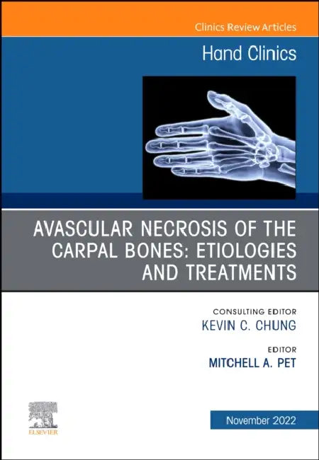 Avascular Necrosis of the Carpal Bones: Etiologies and Treatments, an Issue of Hand Clinics: Volume 38-4 by Mitchell A. Pet