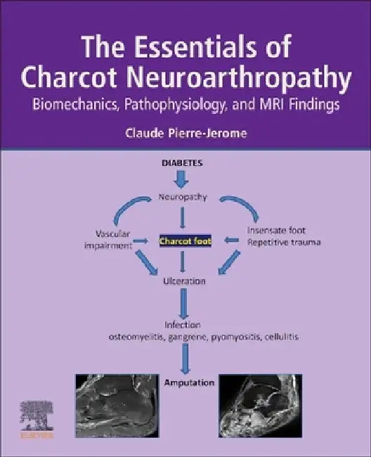 The Essentials of Charcot Neuroarthropathy: Biomechanics, Pathophysiology, and MRI Findings by Claude Pierre-Jerome