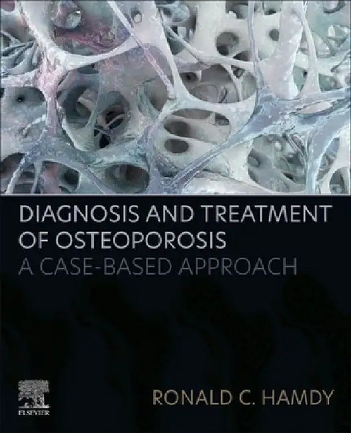 Diagnosis and Treatment of Osteoporosis: A Case-Based Approach by Ronald C. Hamdy