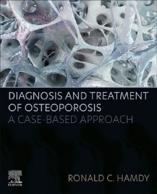 Diagnosis and Treatment of Osteoporosis: A Case-Based Approach by Ronald C. Hamdy