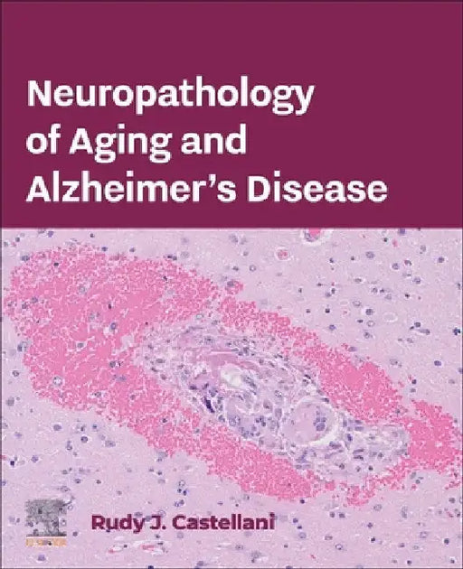 Neuropathology of Aging and Alzheimer's Disease by Rudy J. Castellani