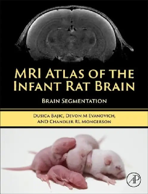 MRI Atlas of the Infant Rat Brain: Brain Segmentation by Dusica Bajic