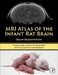 MRI Atlas of the Infant Rat Brain: Brain Segmentation by Dusica Bajic