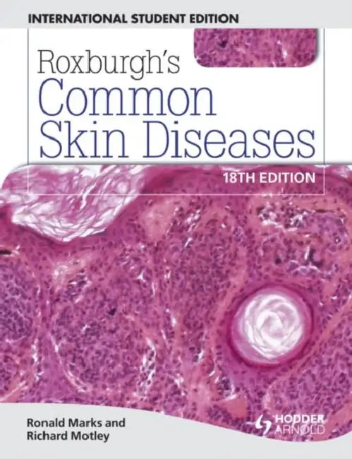 Roxburgh's Common Skin Diseases (Ie) by Marks,Motley