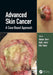 Advanced Skin Cancer: A Case-Based Approach by Debjani Sahni