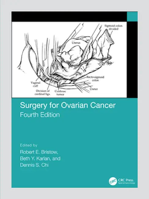 Surgery for Ovarian Cancer by Robert Bristow