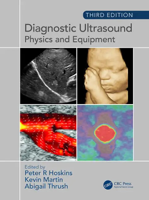 Diagnostic Ultrasound: Physics and Equipment by Peter Hoskins