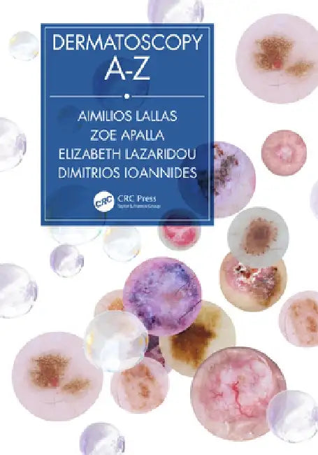 Dermatoscopy A-Z by Aimilios Lallas