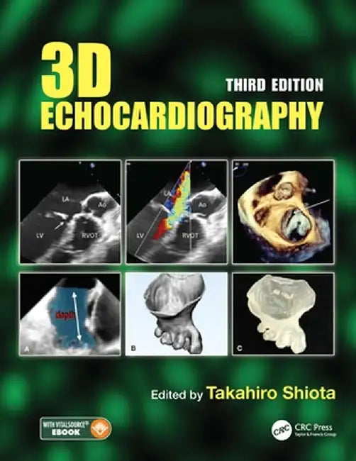 3D Echocardiography by Takahiro Shiota