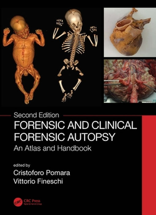 Forensic and Clinical Forensic Autopsy by Cristoforo Pomara