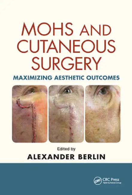 Mohs and Cutaneous Surgery: Maximizing Aesthetic Outcomes by Alexander Berlin