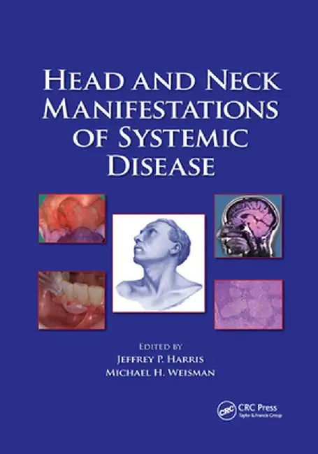 Head and Neck Manifestations of Systemic Disease by Jeffrey P. Harris