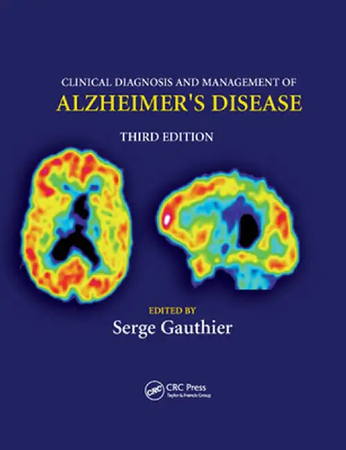 Clinical Diagnosis and Management of Alzheimer's Disease by Serge Gauthier