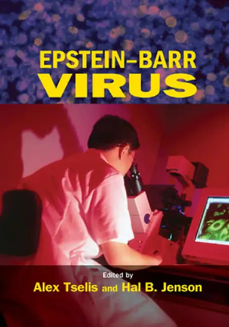 Epstein-Barr Virus by Alex Tselis