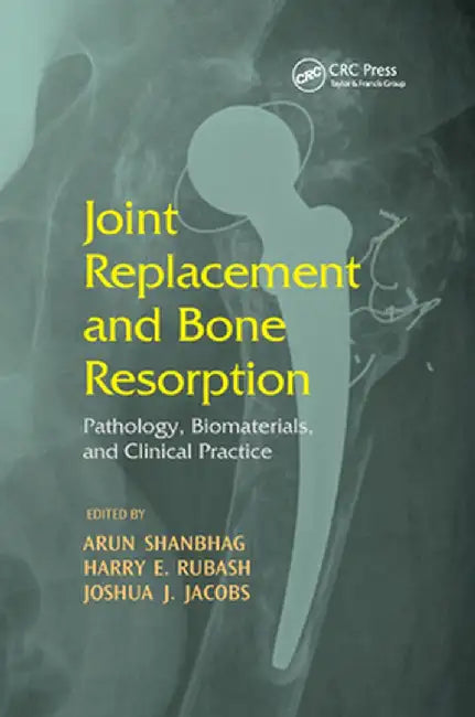 Joint Replacement and Bone Resorption: Pathology, Biomaterials and Clinical Practice by Arun Shanbhag