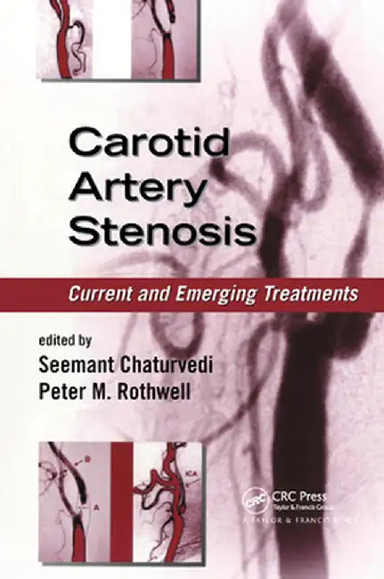 Carotid Artery Stenosis: Current and Emerging Treatments by Seemant Chaturvedi