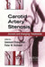 Carotid Artery Stenosis: Current and Emerging Treatments by Seemant Chaturvedi