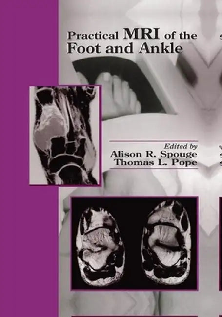 Practical MRI of the Foot and Ankle by Alison R. Spouge