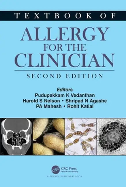 Textbook of Allergy for the Clinician by Pudupakkam K. Vedanthan