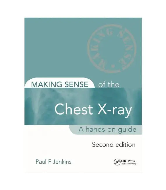 Making Sense of the Chest X-Ray: A Hands-on Guide, 2e by Jenkins Pf