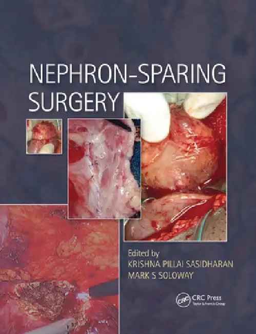 Nephron-Sparing Surgery by Krishna Sasidharan