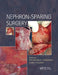 Nephron-Sparing Surgery by Krishna Sasidharan