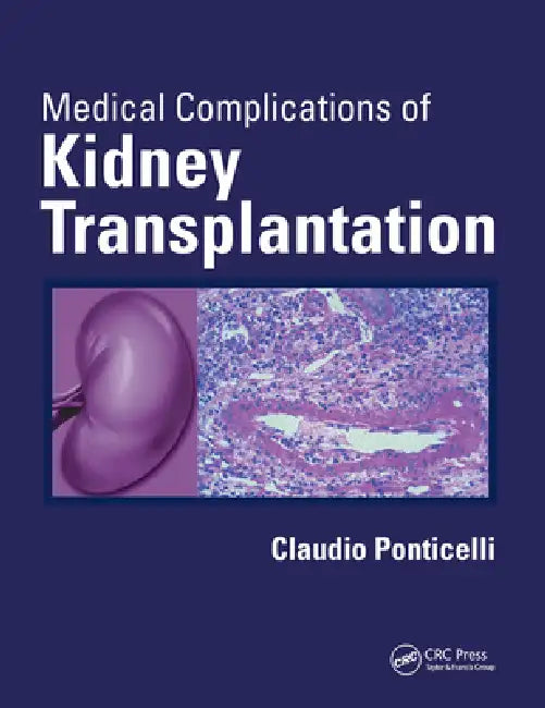 Medical Complications of Kidney Transplantation by Claudio Ponticelli