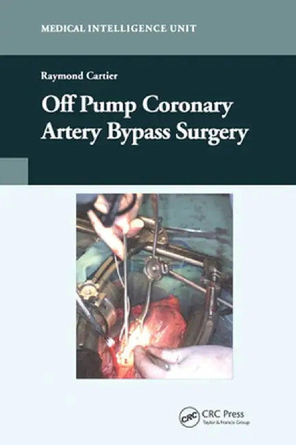 Off-Pump Coronary Artery Bypass Surgery by Raymond Cartier