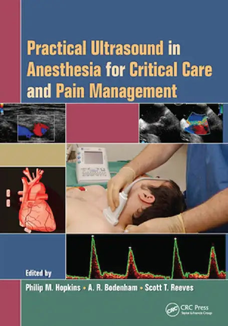 Practical Ultrasound in Anesthesia for Critical Care and Pain Management by Philip M. Hopkins