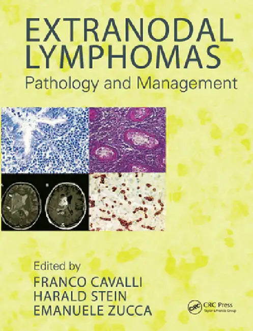 Extranodal Lymphomas: Pathology and Management by Franco Cavalli